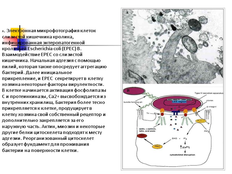 A. Электронная микрофотография клеток слизистой кишечника кролика, инфицированная энтеропатогенной кроличьей Escherichia coli (EPEC) B.